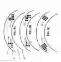 Fig. 06 - Method and apparatus for enhanced corneal accommodation