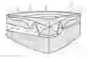 Fig. 01 - Accommodating intraocular lens system having spherical aberration compensation and method