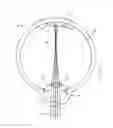 Fig. 03 - Accommodating intraocular lens system having spherical aberration compensation and method