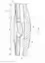 Fig. 06 - Accommodating intraocular lens system having spherical aberration compensation and method