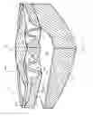 Fig. 07 - Accommodating intraocular lens system having spherical aberration compensation and method