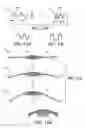 Fig. 05 - Umbrella-shaped accommodating artificial ocular lens (AAOL) device