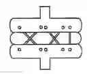 Fig. 01 - CHECK REINS FOR ARTIFICIAL DISC REPLACEMENTS