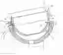 Fig. 01 - Acetabular cup locking mechanism