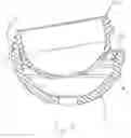 Fig. 07 - Acetabular cup locking mechanism