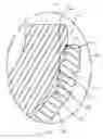Fig. 16 - Acetabular cup locking mechanism