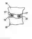Fig. 01 - Bone substitute material