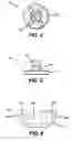 Fig. 03 - Adjustable multi-axis prosthetic ankle and method of use thereof