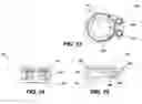Fig. 07 - Adjustable multi-axis prosthetic ankle and method of use thereof