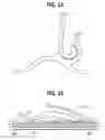 Fig. 20 - Mobility assistance apparatus