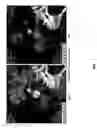Fig. 05 - Calcium cleansing for vascular visualization