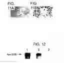 Fig. 07 - Animal model having a chimeric human liver
