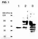 Fig. 02 - Use of regulatory sequences for specific, transient expression in neuronal determined cells