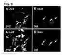 Fig. 05 - Use of regulatory sequences for specific, transient expression in neuronal determined cells