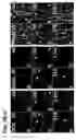 Fig. 10 - Use of regulatory sequences for specific, transient expression in neuronal determined cells