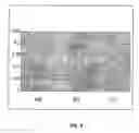 Fig. 04 - Process for proteolytic cleavage and purification of recombinant proteins produced in plants