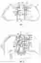 Fig. 04 - Patient bed system