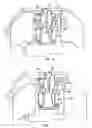 Fig. 05 - Patient bed system