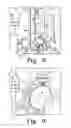 Fig. 15 - Orthopaedic component manufacturing method and equipment