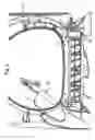 Fig. 05 - Device for drying laundry by means of a current of air