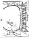 Fig. 04 - Device for drying laundry by means of a current of air