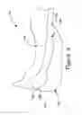 Fig. 06 - Variable friction sole for bowling and other shoes