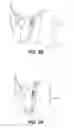 Fig. 08 - Reversible snow pusher and coupler