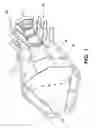 Fig. 02 - Snow pusher for ice and snow removal