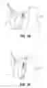 Fig. 08 - Snow pusher for ice and snow removal