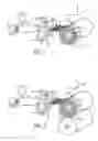 Fig. 02 - Variable coalescer