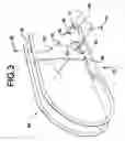 Fig. 04 - Pickup guard mounting arrangement