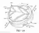 Fig. 10 - Cable wrap security device
