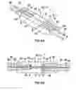 Fig. 05 - Forging method, forged article and forging apparatus