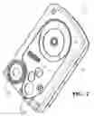 Fig. 03 - Surgical cassette