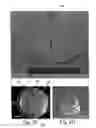 Fig. 06 - Overlay measurement methods with firat based probe microscope