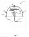 Fig. 02 - Distributed Pressure Sensoring System