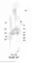 Fig. 09 - Screwdriver handle