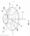 Fig. 07 - Watercraft recovery device