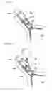 Fig. 10 - Alert apparatus for use with fasteners