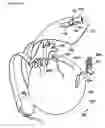 Fig. 17 - Alert apparatus for use with fasteners