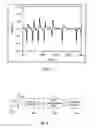 Fig. 04 - Wireless detection of motion
