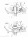 Fig. 05 - Assembling an annular combustion chamber of a turbomachine