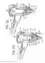 Fig. 12 - Nebulizer apparatus and method