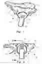 Fig. 02 - Pediatric tracheostomy mask