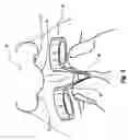 Fig. 03 - Clip-in nostril expander