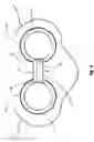 Fig. 04 - Clip-in nostril expander
