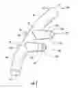 Fig. 02 - Nasal cannula