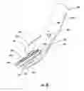 Fig. 11 - Nasal cannula