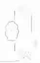 Fig. 03 - System and method for the digital specification of head shape data for use in developing custom hair pieces