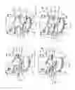 Fig. 03 - Felling head accumulator arm